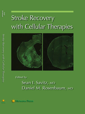 cover image of Stroke Recovery with Cellular Therapies
